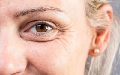 How to Care for Eyelid Skin