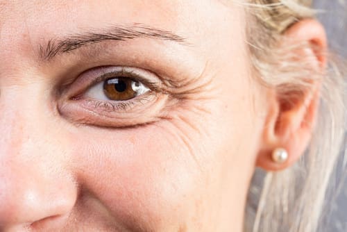 How to Care for Eyelid Skin