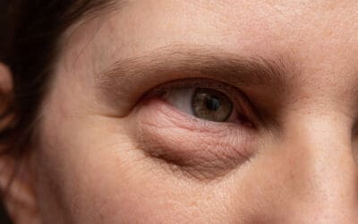 Brighten Up! 🌟 Tips for reducing under-eye bags.